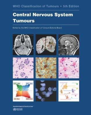 Who Classification of Tumours: Central Nervous System Tumours фото книги