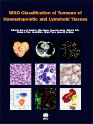 WHO Classification of Tumours of Haematopoietic and Lymphoid Tissues фото книги