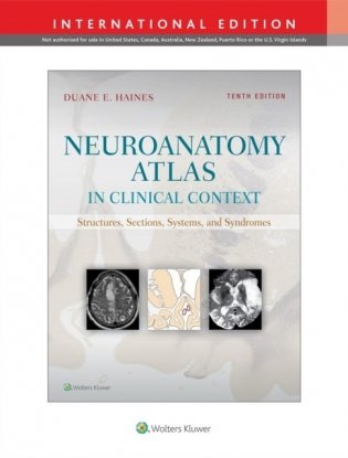 Neuroanatomy Atlas in Clinical Context. Structures, Sections, Systems, and Syndromes фото книги