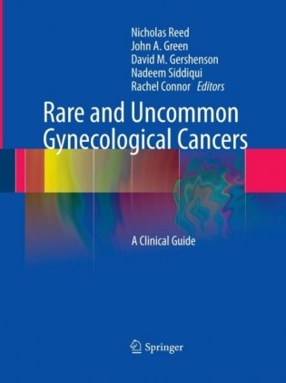 Rare and uncommon gynecological cancers фото книги
