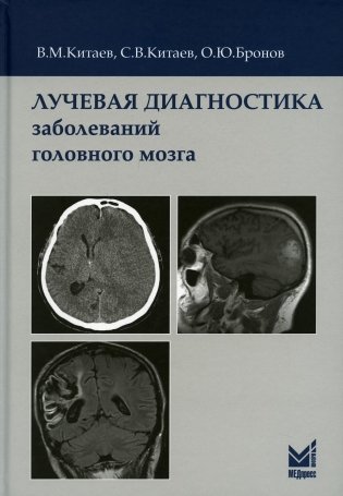 Лучевая диагностика заболеваний головного мозга. 3-е изд фото книги
