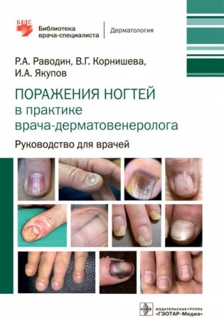 Поражения ногтей в практике врача-дерматовенеролога: руководство для врачей фото книги