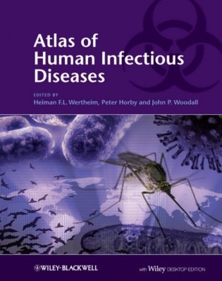 Atlas of human infectious diseases фото книги