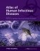 Atlas of human infectious diseases фото книги маленькое 2