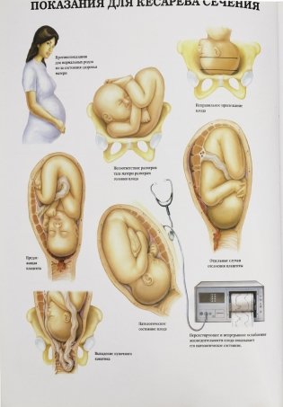 Анатомия человека: болезни и нарушения фото книги 7