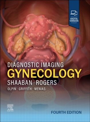 Diagnostic Imaging: Gynecology фото книги