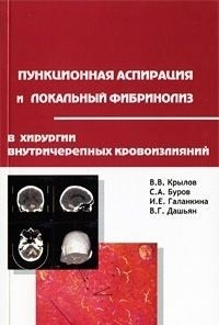 Пункционная аспирация и локальный фибринолиз в хирургии внутричерепных кровоизлияний фото книги