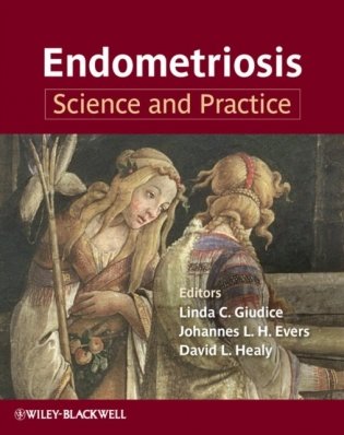 Endometriosis: Science and Practice фото книги