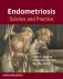 Endometriosis: Science and Practice фото книги маленькое 2