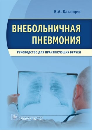 Внебольничная пневмония фото книги