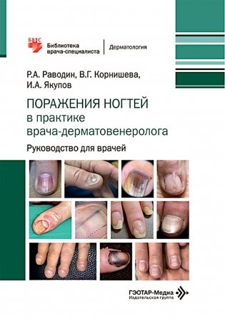 Поражения ногтей в практике врача-дерматовенеролога: руководство для врачей фото книги
