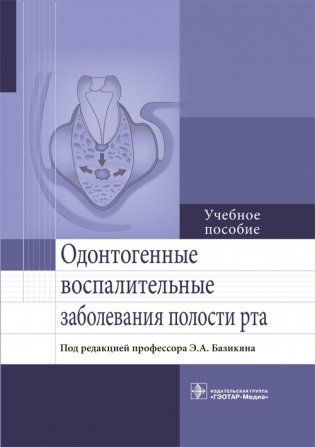Одонтогенные воспалительные заболевания полости рта фото книги
