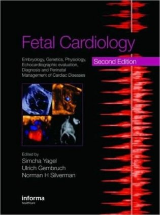 Fetal Cardiology: Embryology, Genetics, Physiology, Echocardiography Evaluation, Diagnosis and Perinatal Management of Cardiac Diseases фото книги