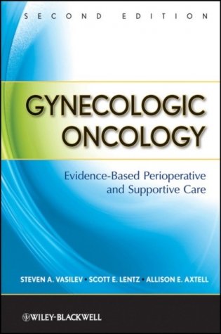 Gynecologic Oncology: Evidence-Based Perioperative and Supportive Care, 2nd Edition фото книги