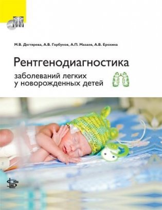 Новорожденные: рентгенодиагностика заболеваний легких фото книги