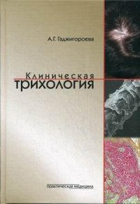 Клиническая трихология фото книги