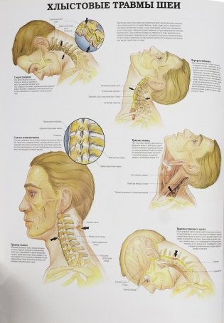 Анатомия человека: болезни и нарушения фото книги 6