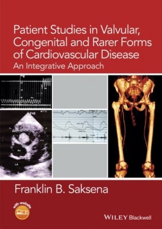 Patient Studies in Valvular, Congenital and Rarer Forms of Cardiovascular Disease: An Integrative Approach фото книги