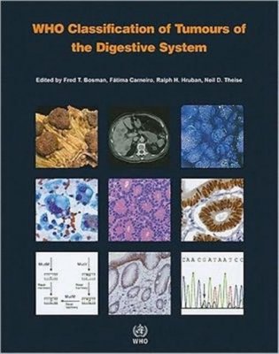 WHO Classification of Tumours of Digestive System фото книги