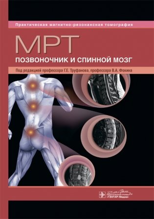 МРТ. Позвоночник и спинной мозг фото книги