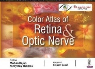 Color Atlas Of Retina & Optic Nerve фото книги