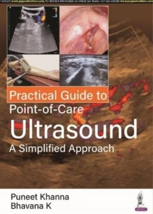Practical Guide To Point-Of-Care Ultrasound: A Simplified Approach фото книги