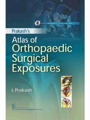 Prakash Atlas Of Orthopaedic Surgical Exposures Included 1 Audio Cd And 1 Multimedia Dvd (Hb 2017) фото книги