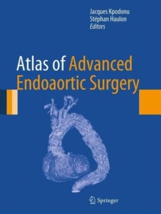 Atlas of Advanced Endoaortic Surgery фото книги