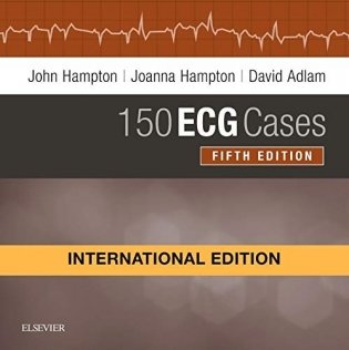 150 ECG Cases фото книги
