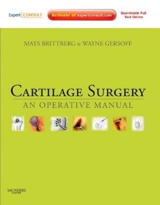 Cartilage Surgery фото книги