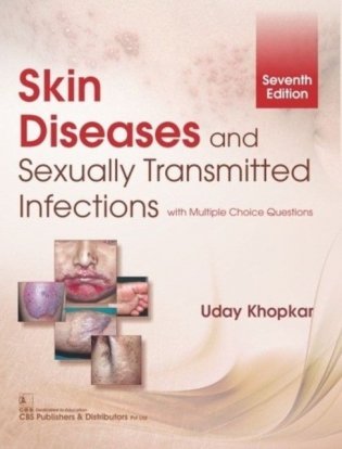 Skin Diseases And Sexually Transmitted Infections (Pb 2019) фото книги