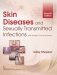 Skin Diseases And Sexually Transmitted Infections (Pb 2019) фото книги маленькое 2