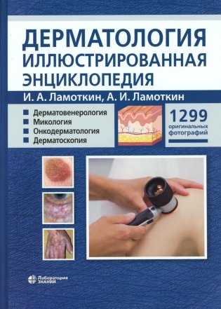 Дерматология. Иллюстрированная энциклопедия. Дерматовенерология. Микология. Онкодерматология. Дерматоскопия фото книги