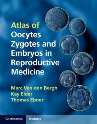 Atlas of Oocytes, Zygotes and Embryos in Reproductive Medicine Hardback with CD-ROM фото книги