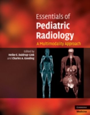 Essentials of Pediatric Radiology фото книги