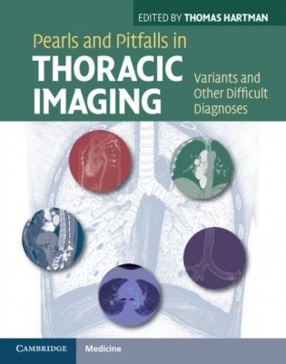 Pearls and Pitfalls in Thoracic Imaging фото книги