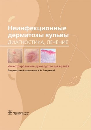 Неинфекционные дерматозы вульвы. Диагностика, лечение фото книги