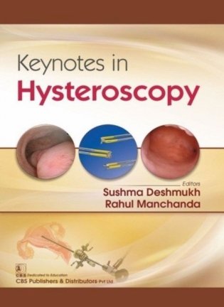 Keynotes In Hysteroscopy (Pb 2019) фото книги