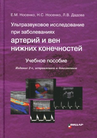 Ультразвуковое исследование при заболеваниях артерий и вен нижних конечностей: Учебное пособие. 2-е изд., испр.и доп фото книги
