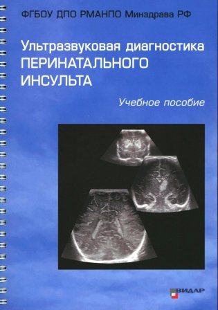 Ультразвуковая диагностика перинатального инсульта: Учебное пособие фото книги