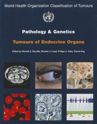 WHO Classification of Tumours Pathology & Genetics of Tumours of Endocrine Organs. фото книги