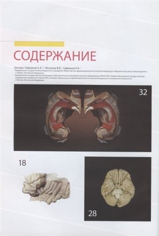 Атлас нормальной анатомии поверхности головного мозга при МР-томографии фото книги 2