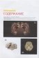 Атлас нормальной анатомии поверхности головного мозга при МР-томографии фото книги маленькое 3