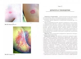 Физиотерапия в дерматологии фото книги 2