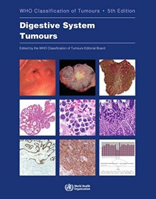 Digestive system tumours фото книги