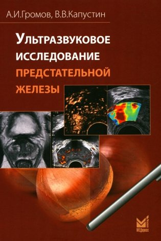 Ультразвуковое исследование предстательной железы фото книги