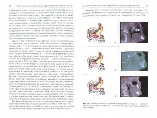 Конусно-лучевая томография в дентальной имплантологии фото книги 2