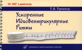 Ускоренные идиовентрикулярные ритмы: клинико-электрокардиографические особенности, систематизация по ЭКГ-характеристикам, дифференцирование с другими фото книги