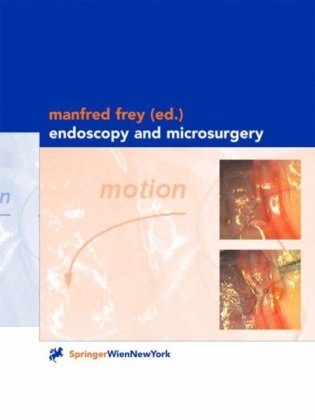 Endoscopy and Microsurgery фото книги