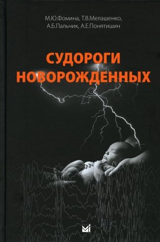 Судороги новорожденных фото книги